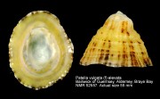 Patella vulgata